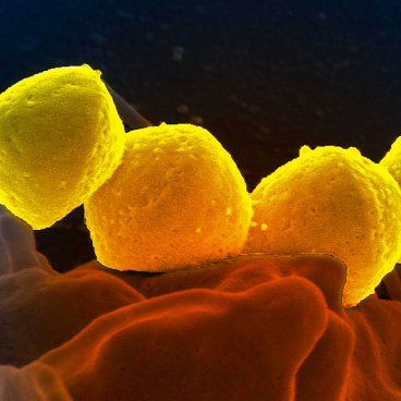 Bacterie Streptocoque Groupe A 01